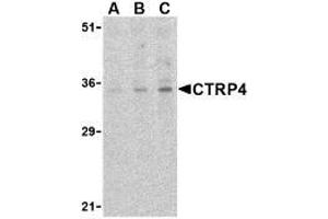 Western blot analysis of CTRP4 in rat brain cell lysate with AP30252PU-N CTRP4 antibody at (A) 1, (B) 2, and (C) 4 μg/ml. (C1QTNF4 抗体  (C-Term))