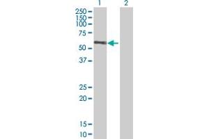 Western Blot analysis of RGL4 expression in transfected 293T cell line by RGL4 MaxPab polyclonal antibody. (RGL4 抗体  (AA 1-410))