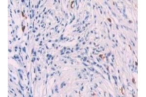 Immunohistochemistry (IHC) image for anti-Platelet Factor 4 (PF4) (AA 31-101) antibody (ABIN7431254)