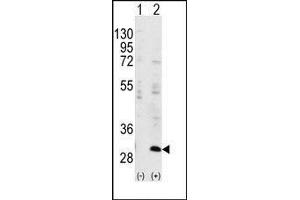 Western blot analysis of IGFBP3(arrow) using rabbit polyclonal IGFBP3 Antibody.