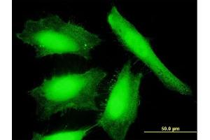 Immunofluorescence of purified MaxPab antibody to NXN on HeLa cell.