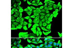 Immunofluorescence analysis of MCF-7 cells using DCD Polyclonal Antibody (Dermcidin 抗体)