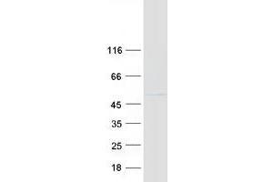 Western Blotting (WB) image for RNA Binding Motif Protein 17 (RBM17) (Transcript Variant 1) protein (Myc-DYKDDDDK Tag) (ABIN2730605)