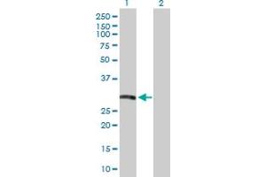 Western Blot analysis of HLA-DRB5 expression in transfected 293T cell line by HLA-DRB5 MaxPab polyclonal antibody. (HLA-DRB5 抗体  (AA 1-266))