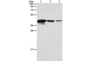Western Blot analysis of Human endometrial carcinoma tissue, A172 and U937 cell using TWF2 Polyclonal Antibody at dilution of 1:800 (TWF2 抗体)