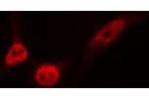 ABIN6276751 staining HeLa cells by IF/ICC. (ETS1 抗体  (Internal Region))