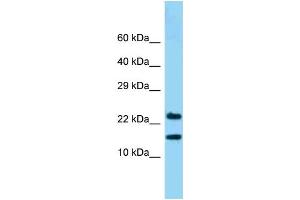 WB Suggested Anti-NDUFB10 Antibody Titration: 1. (NDUFB10 抗体  (C-Term))