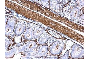 IHC-P Image alpha Cardiac Muscle Actin antibody detects alpha Cardiac Muscle Actin protein at cytoplasm on mouse small intestine by immunohistochemical analysis. (ACTC1 抗体)