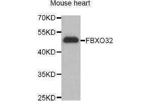 Western blot analysis of extracts of Mouse heart cell lines, using FBXO32 antibody.