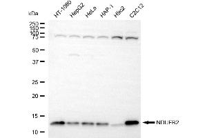 Western blotting analysis using NDUFB2 antibody (ABIN7799550). (Recombinant NDUFB2 抗体)