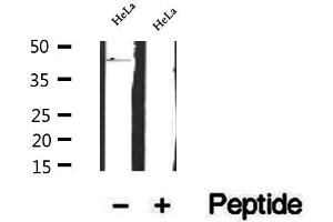 Western blot analysis of extracts of HeLa cells, using FBXO22 antibody. (FBXO22 抗体  (Internal Region))