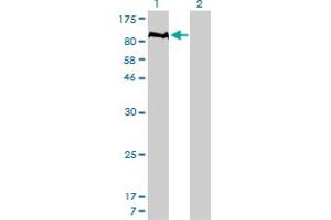 Western Blot analysis of PTPN22 expression in transfected 293T cell line by PTPN22 monoclonal antibody (M01), clone 4F6. (PTPN22 抗体  (AA 1-179))