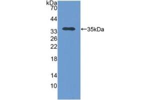Western blot analysis of recombinant Human TOMM70A. (TOM70 抗体  (AA 333-608))