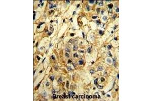 Immunohistochemistry (Paraffin-embedded Sections) (IHC (p)) image for anti-TIMP Metallopeptidase Inhibitor 1 (TIMP1) (AA 41-70), (N-Term) antibody (ABIN390664)