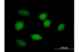 Immunofluorescence of purified MaxPab antibody to BLVRA on HeLa cell. (Biliverdin Reductase 抗体  (AA 1-296))