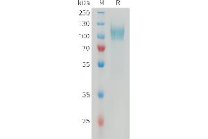SDS-PAGE (SDS) image for Platelet Derived Growth Factor Receptor alpha (PDGFRA) (AA 24-528) protein (His tag) (ABIN7538479)