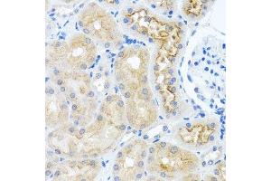 Immunohistochemistry of paraffin-embedded rat kidney using RPS2 antibody. (RPS2 抗体  (AA 1-293))
