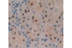 IHC-P analysis of Human Tissue, with DAB staining. (PLAGL1 抗体  (AA 226-362))