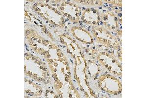 Immunohistochemistry of paraffin-embedded human kidney using PDGFRB antibody at dilution of 1:200 (x400 lens) (PDGFRB 抗体  (AA 887-1106))