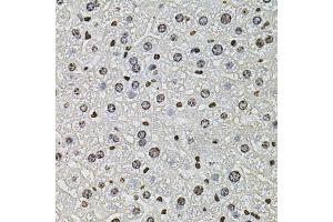 Immunohistochemistry of paraffin-embedded mouse liver using H2AFZ antibody (ABIN5973977) at dilution of 1/100 (40x lens). (H2AFZ 抗体)