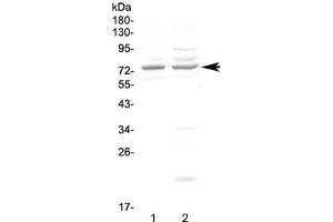Western blot testing of human 1) COLO320 and 2) U-87 MG cell lysate with CHM antibody at 0. (CHM 抗体)