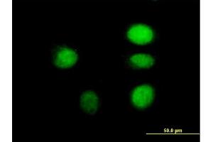 Immunofluorescence of purified MaxPab antibody to ARNT on HeLa cell. (ARNT 抗体  (AA 1-789))