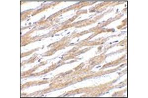 Immunohistochemistry of PDL-1 in human heart tissue with this product at 2. (PD-L1 抗体  (Center))