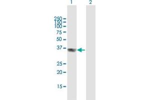 Western Blot analysis of GIPC2 expression in transfected 293T cell line by GIPC2 MaxPab polyclonal antibody. (GIPC2 抗体  (AA 1-315))