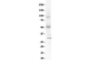 Western Blotting (WB) image for anti-SRY (Sex Determining Region Y)-Box 4 (SOX4) (N-Term) antibody (ABIN2780469)