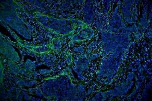 IF analysis of VCL using anti-VCL antibody (ABIN7599003). (Vinculin 抗体  (AA 1-149))