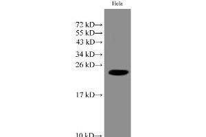 Western Blot analysis of Hela cell using IMP3 Polyclonal Antibody at dilution of 1:1000 (IMP3 抗体)