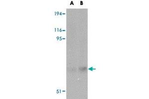 Western blot analysis of MATN2 in human liver tissue lysate with MATN2 polyclonal antibody  at (A) 1 and (B) 2 ug/mL . (MATN2 抗体  (C-Term))