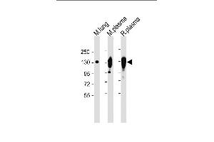All lanes : Anti-CP Antibody (Center) at 1:2000 dilution Lane 1: Mouse lung lysate Lane 2: Mouse plasma lysate Lane 3: Rat plasma lysate Lysates/proteins at 20 μg per lane. (Ceruloplasmin 抗体  (Center))