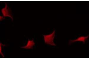 ABIN6275894 staining Hela by IF/ICC. (Fibrinogen beta Chain 抗体  (C-Term))