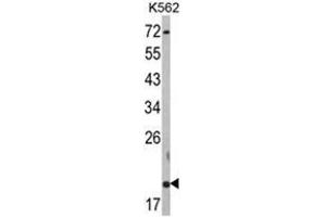 Western blot analysis of RNF5 Antibody (N-term) in K562 cell line lysates (35ug/lane). (RNF5 抗体  (N-Term))