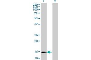 Western Blot analysis of ZNF593 expression in transfected 293T cell line by ZNF593 MaxPab polyclonal antibody. (ZNF593 抗体  (AA 1-116))