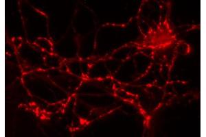 Immunolabeling of cultured hippocampus neurons (dilution 1 : 2000). (GAD65 抗体  (AA 3-96))
