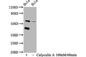 Western Blot Positive WB detected in Hela whole cell lysate(treated with Calyculin A or not) All lanes Phospho-EIF2AK2 antibody at 1.