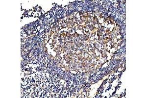 IHC analysis of VCAM1 using anti-VCAM1 antibody (ABIN5692810). (VCAM1 抗体  (AA 25-270))