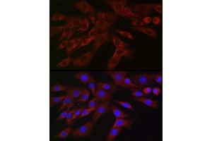 Immunofluorescence (IF) image for anti-Polo-Like Kinase 2 (PLK2) (AA 322-671) antibody (ABIN6145776)