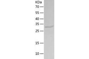 Junctional Sarcoplasmic Reticulum Protein 1 (JSRP1) (AA 1-331) protein (His-IF2DI Tag)
