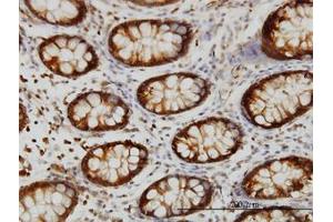 Image no. 4 for anti-Heat Shock 70kDa Protein 2 (HSPA2) (AA 1-640) antibody (ABIN598754) (HSPA2 抗体  (AA 1-640))