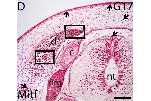 Potential migratory pathways for late neural crest cells and melanoblasts. (MITF 抗体  (AA 351-450))