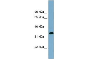WB Suggested Anti-AWAT1 Antibody Titration:  0.