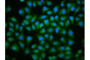 Immunofluorescence staining of Hela cells with ABIN7174438 at 1:100, counter-stained with DAPI. (UBE2D2 抗体  (AA 1-147))