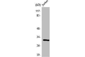 Western Blot analysis of Jurkat cells using SURF-1 Polyclonal Antibody (SURF1 抗体  (Internal Region))