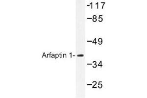Image no. 1 for anti-ADP-Ribosylation Factor Interacting Protein 1 (ARFIP1) antibody (ABIN317818) (ARFIP1 抗体)