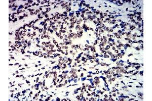 Immunohistochemistry (IHC) image for anti-Heterogeneous Nuclear Ribonucleoprotein M (HNRNPM) (AA 17-161) antibody (ABIN7193216)