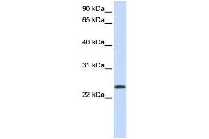 ARF1 antibody used at 1 ug/ml to detect target protein. (ARF1 抗体  (Middle Region))