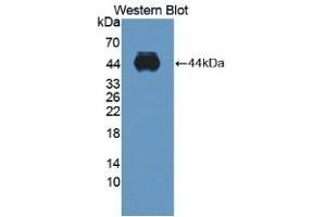 Detection of recombinant ADAMTS10 using Polyclonal Antibody to A Disintegrin And Metalloproteinase With Thrombospondin 10 (ADAMTS10) (ADAMTS10 抗体  (AA 239-602))